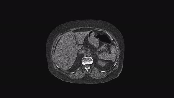 Voluminous MRI of the Abdominal Cavity, Gastrointestinal Tract, Bladder