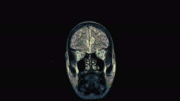 Bulk Multicolored MRI Brain, Head Scans and Tumor Detection. Diagnostic Medical Tool