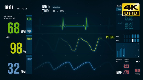 EKG ECG Screen Monitor Advance