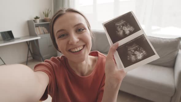 POV of Pregnant Woman Showing Baby X Ray at Camera