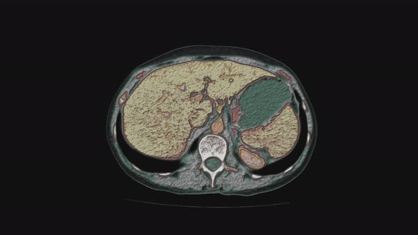 Bulk Multicolored MRI of the Female Pelvic Organs Abdominal Cavity Gastrointestinal Tract and