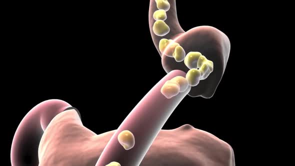 Food moving through the digestive tract