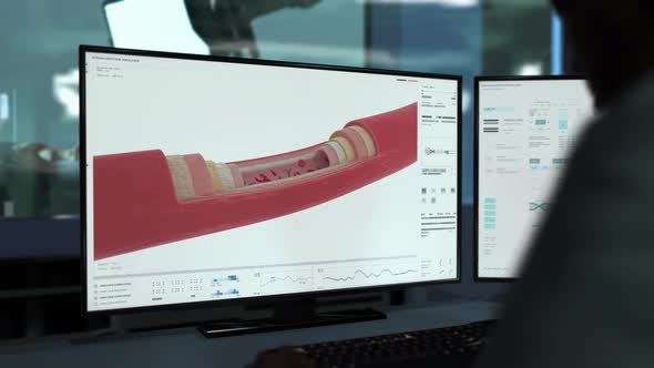 Molecular Examination System Detects Antibodies In Bloodstream Of Patient alt