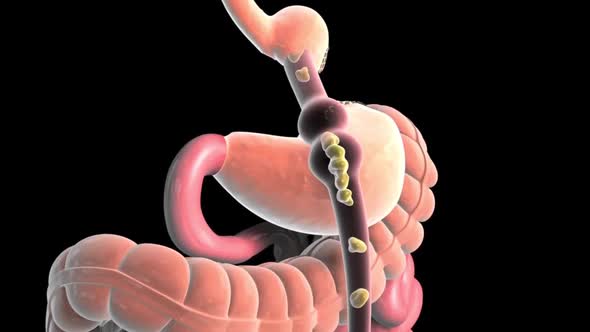 Food moving through the digestive tract alt