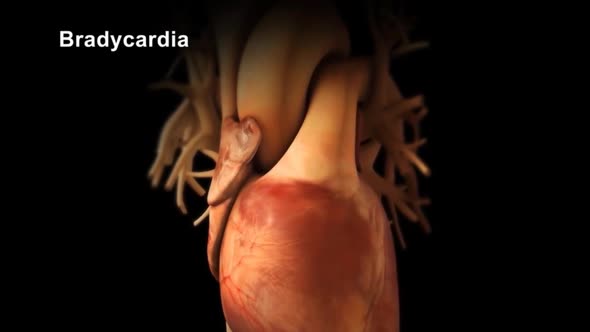 The bradycardia abnormally slow heart action