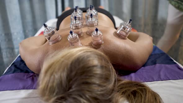 Looking down a woman’s body from her head showing all the cupping in place on her back. Camera slide