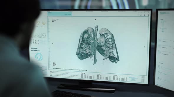 Anatomical ultrasound analysis system has detected cancer in the patients lungs alt