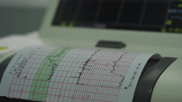 Electronic Cardiotocography Machine Monitoring Fetal Heart Contractions Of Uterus