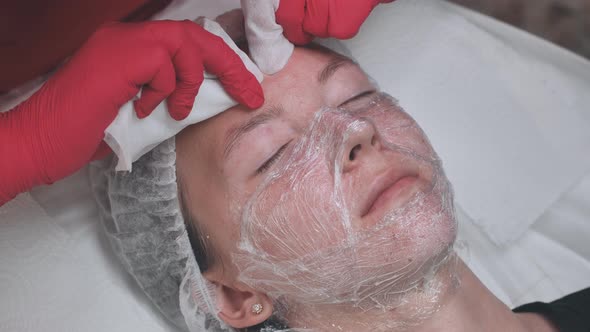 Squeezing Out Acne After the Facial Hydrogenation Process