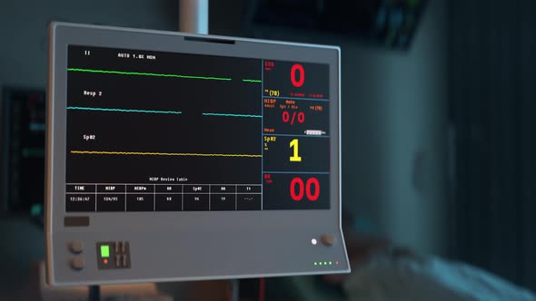 Medical ECG Device Displays Dying Vital Signs Because Of Illness Progression alt