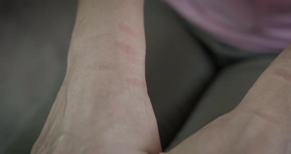 Tortured Woman Hands