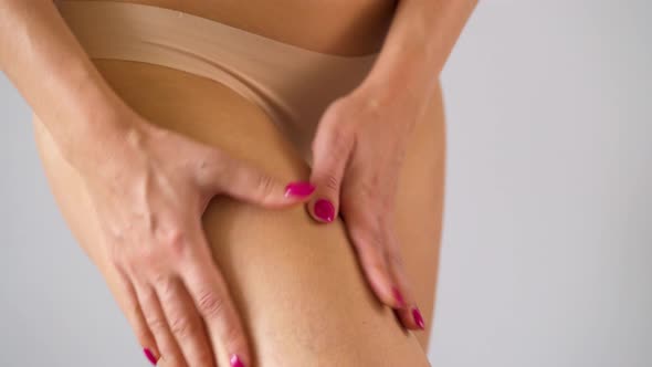 Woman Compressing Thigh Skin and Checks for Stretch Marks and Cellulite