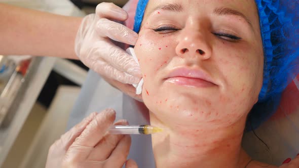 Modern Beauty Invasive Procedure on Face