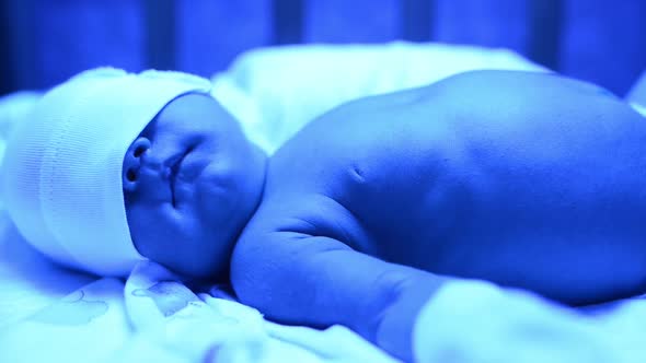 Newborn Having a Treatment for Jaundice Under Ultraviolet Lamp in Home Bed