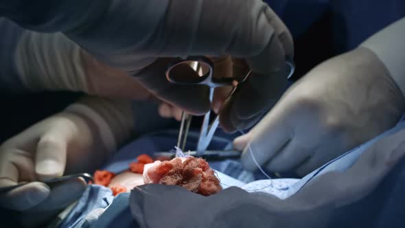Surgeons Suturing Wound