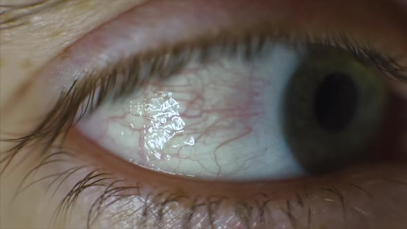 Close Up Of Man's Eye, Nervous Movement