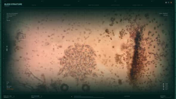 Microscopic analysis of the blood structure with spreading infection bacteria