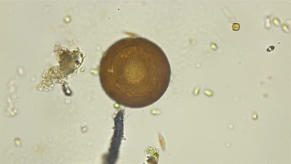 Arcella's Amoeba Under a Microscope, Usually Found in Fresh Water and Mosses