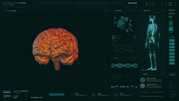 Futuristic Medical Analysis Of Patients Brain Organ Detecting Tumor Formation alt