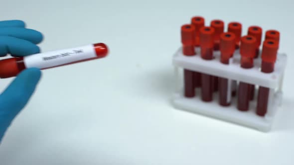 Western Blot, Doctor Showing Blood Sample in Tube, Lab Research, Health Check-Up