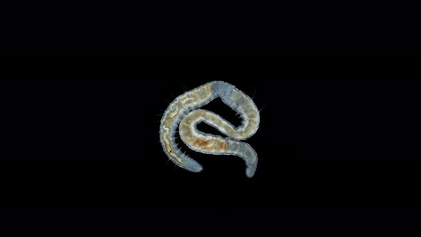 worm Nais sp. under a microscope, Family Naididae, a class of Oligochaeta