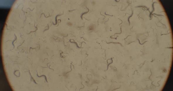 A Colony of Microorganisms, C-elegans Nematode Worms Under the Microscope, Macro