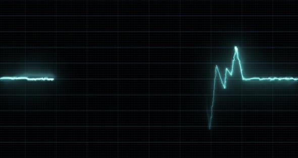 EKG - Heartbeat Display Monitor Looped