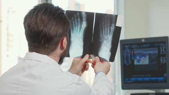 Rear View Shot of a Male Doctor Looking at Foot X-ray of a Patient