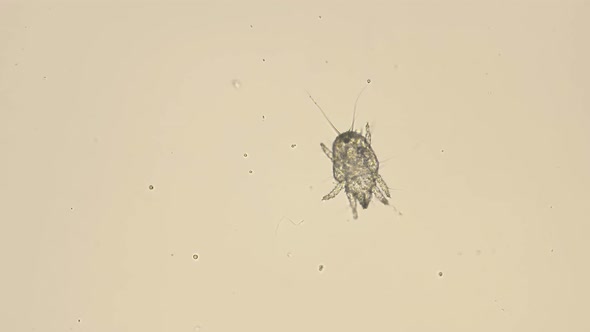 a Granary or Flour Mite Under a Microscope