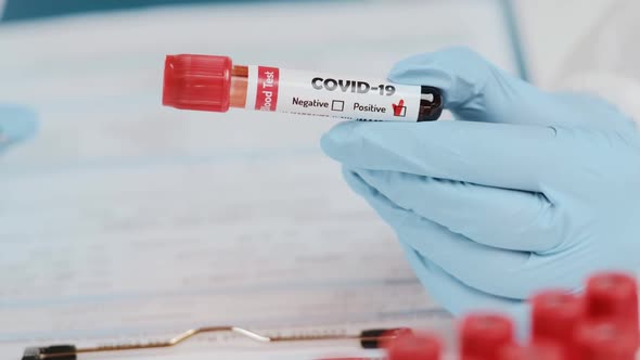 Close Up of Doctors Hand Holding Tube with Positive Blood Test for COVID-19