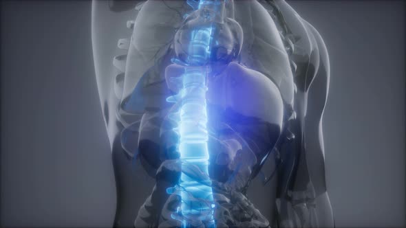 Backache in Back Bones alt