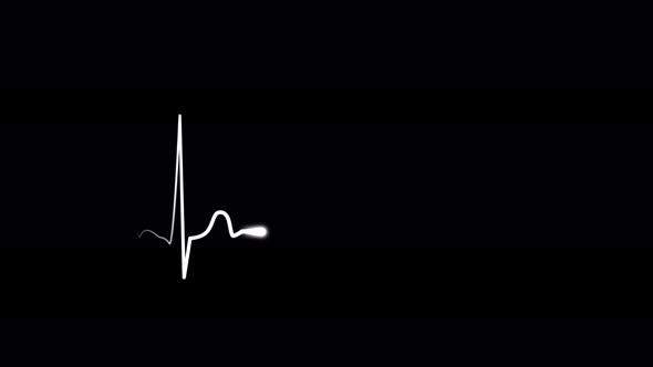 Heartbeat Display Pulse Animation