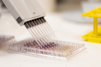 Medical research with multi channel pipette in hospital