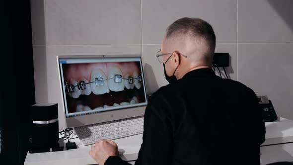 Doctor Orthodontist Looks at the Computer Monitor Studying the Picture of the Patient's Teeth