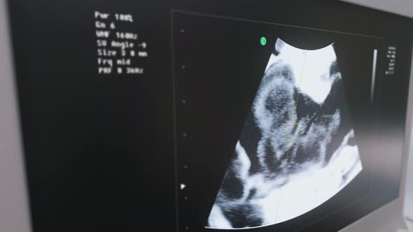Medical examination scanner is detecting the sound of the unborn childs heart alt