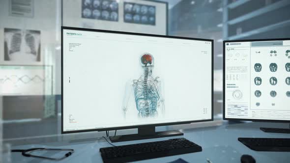 Anatomical monitoring of a damaged brain using software at health care facility alt