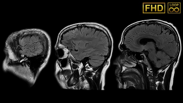 Mri Profile Head