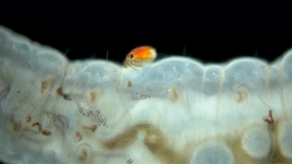 Larva mite Hydrachnidia and Hydrophilidae larva under a microscope