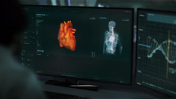 Doctor diagnosed the deadly Cardiac Ischemia illness after x-ray scan analysis alt