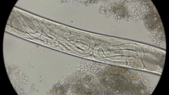 Young Worms Inside Female Turbatrix Aceti