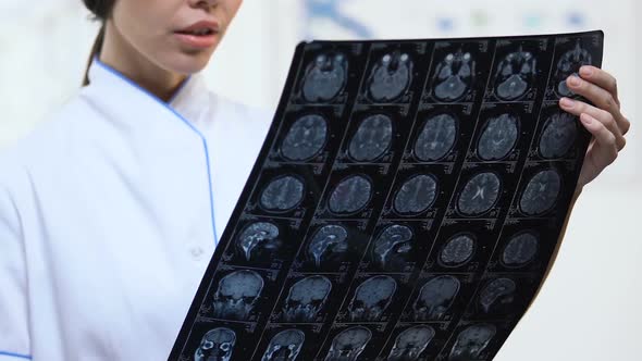 Female Neurologist Holding Brain X-Ray With Negative Examination Result, Illness