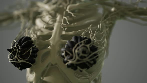 Medical Scan Woman Breast Cancer alt