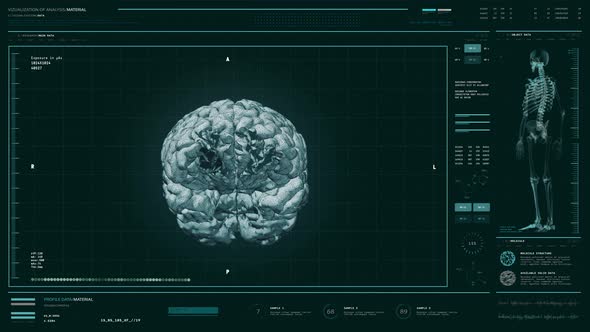 Modern X-ray Screening System Device Scans Patients Head At A Medical Laboratory alt