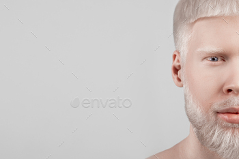 Half face portrait of albino guy with pale skin and white hair over light grey background, free / Photodune, Misc