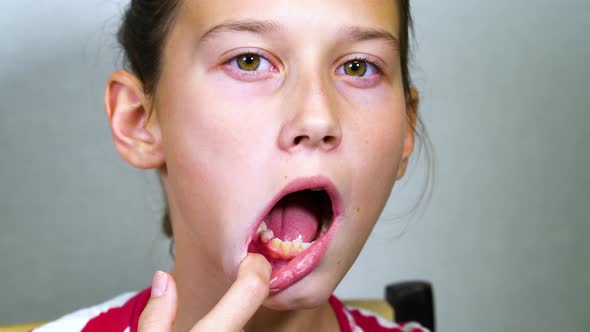 Girl Having Bad Luck with Removing Shaky Baby Tooth