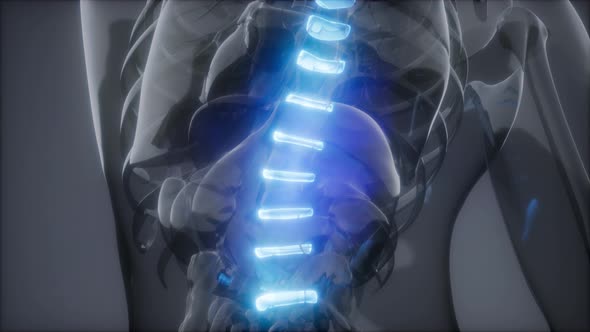 Backache in Back Bones alt