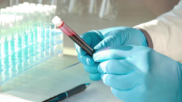 Researcher Carefully Keeping a Test Tube Witn Blood Sample in a Hands in Protective Gloves.