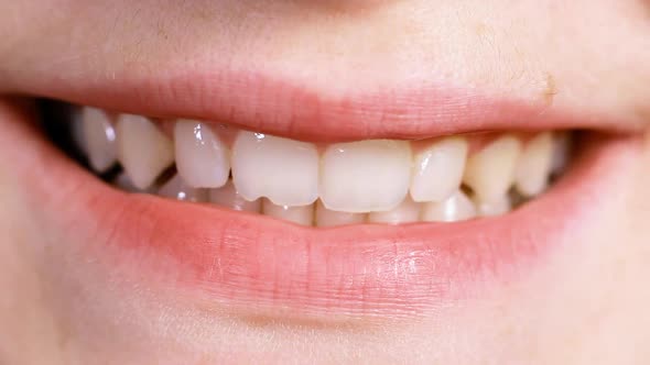 Macro Video of a Man Smiling Shows the Tongue Chipped Tooth