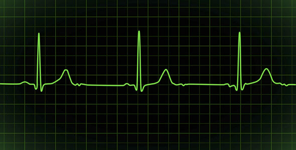 Heartbeat Monitor EKG Cardiogram Loopable