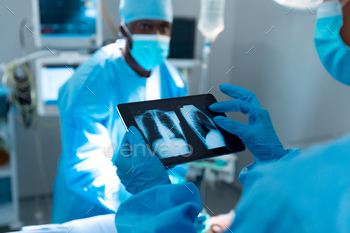 Doctor wearing surgical gloves looking at lung x-ray on tablet / Photodune, Misc